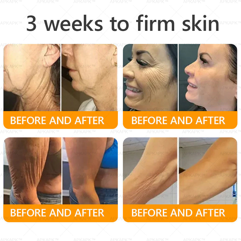 🐝 🐝APKAPK® Bee venom Comprehensive Cream 🔥 Sagging Skin, Fine Lines, Loss of Firmness, Flat Bust, Drooping Hips, and More