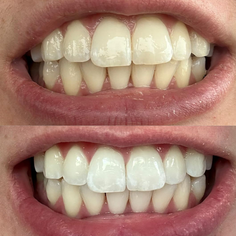 Smileasego™ Whitening Remineralizing Tooth Powder, Fluoride Free, Teeth Polish & Stain Remover