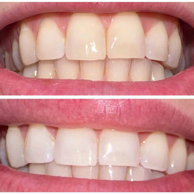Smileasego™ Whitening Remineralizing Tooth Powder, Fluoride Free, Teeth Polish & Stain Remover