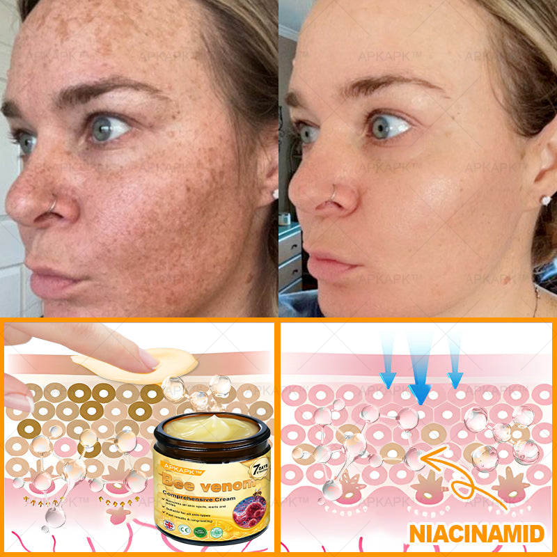 🐝 🐝APKAPK® Bee venom Comprehensive Cream 🔥 Sagging Skin, Fine Lines, Loss of Firmness, Flat Bust, Drooping Hips, and More