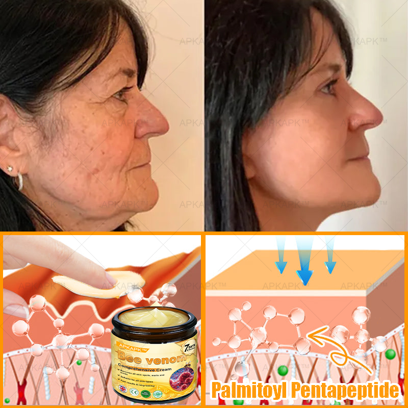 🐝 🐝APKAPK® Bee venom Comprehensive Cream 🔥 Sagging Skin, Fine Lines, Loss of Firmness, Flat Bust, Drooping Hips, and More