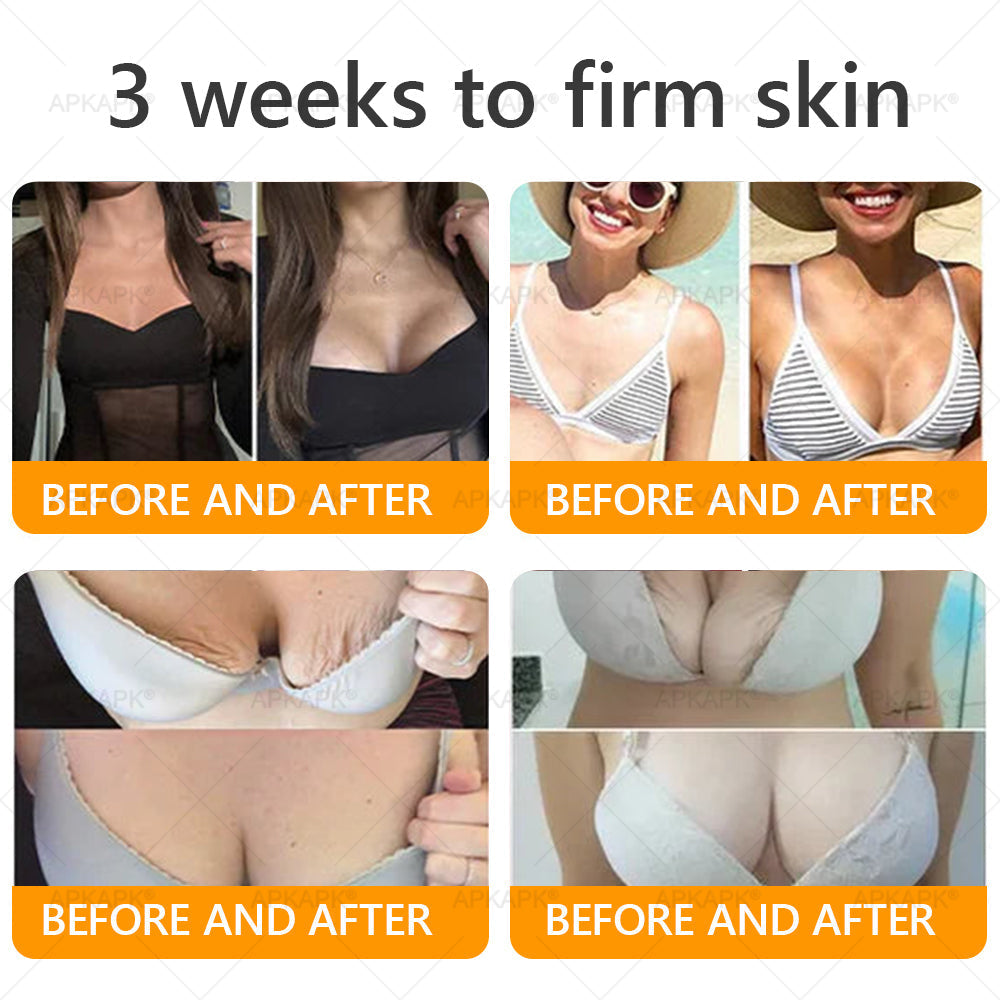 🐝 🐝APKAPK® Bee venom Comprehensive Cream 🔥 Sagging Skin, Fine Lines, Loss of Firmness, Flat Bust, Drooping Hips, and More