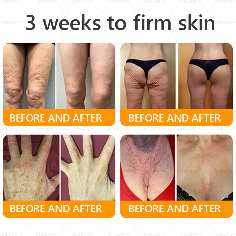 🐝 🐝APKAPK® Bee venom Comprehensive Cream 🔥 Sagging Skin, Fine Lines, Loss of Firmness, Flat Bust, Drooping Hips, and More