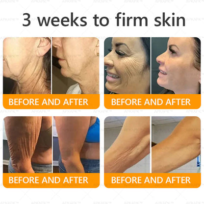 🐝 🐝APKAPK® Bee venom Comprehensive Cream 🔥 Sagging Skin, Fine Lines, Loss of Firmness, Flat Bust, Drooping Hips, and More