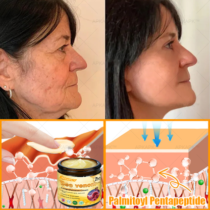 🐝 🐝APKAPK® Bee venom Comprehensive Cream 🔥 Sagging Skin, Fine Lines, Loss of Firmness, Flat Bust, Drooping Hips, and More