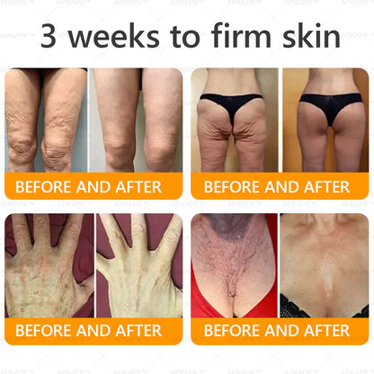 🐝 🐝APKAPK® Bee venom Comprehensive Cream 🔥 Sagging Skin, Fine Lines, Loss of Firmness, Flat Bust, Drooping Hips, and More